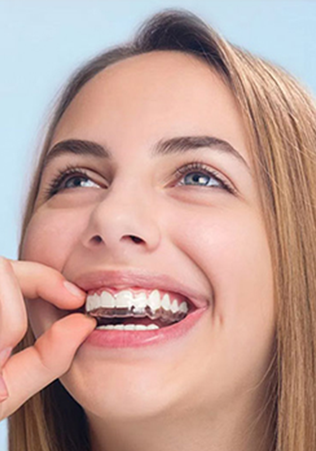 Invisalign Invisalign